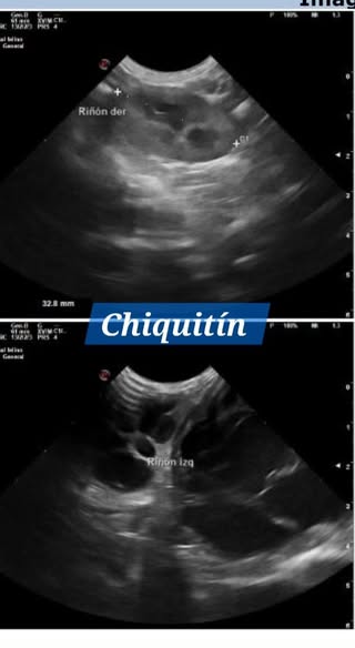 CHIQUITIN eco